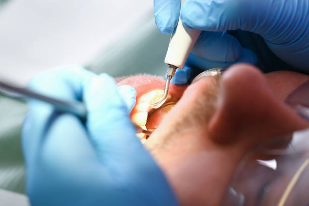 Best Cosmetic Emergency Dentistry in Aurora, IL
