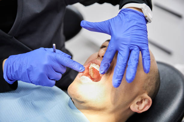 Best Urgent Care for Lost Fillings or Crowns in Aurora, IL