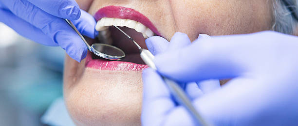 Best Emergency Dental Care for Broken or Chipped Teeth in Aurora, IL
